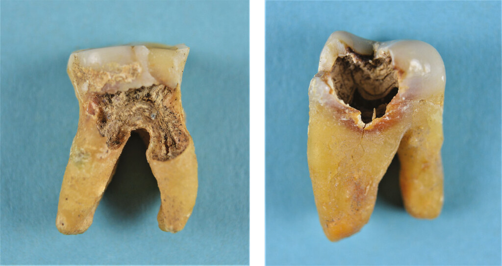 Figure 11