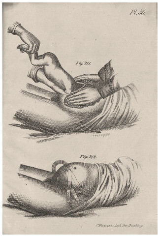 Instruction for how a cesarean section that might save the life of the fetus is performed on a woman.