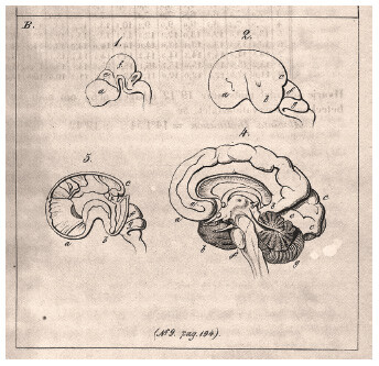 Diagrammatic representation of fetal brains