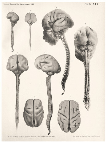 Fetal brains and spinal cords from different angles.