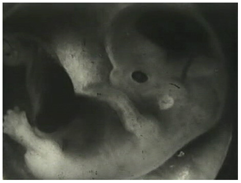 Black and white television image of a fetus in close-up. The fetus is shot in profile and one can see body parts in early development.