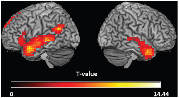 FIGURE 11