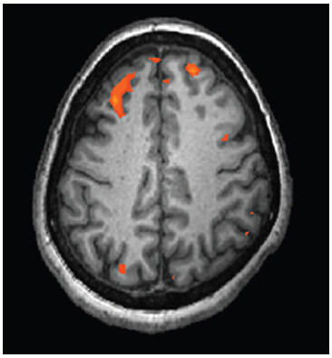 FIGURE 15